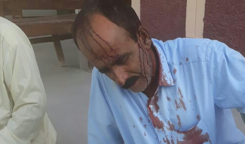 وارياسو ۽ بهاول ٻٻر ۾ جهيڙن جا واقعا 3 زخمي،ڪيس داخل نه ٿيا