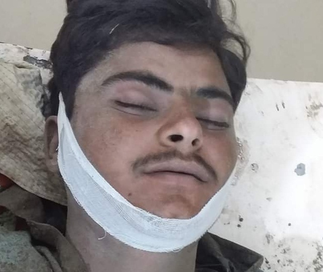 بجلي جي ڪرنٽ لڳڻ سبب نوجوان فوت