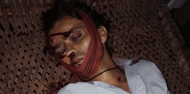 ٽئنڪر ۽ موٽر سائيڪل ۾ ٽڪر هڪ فوت هڪ زخمي