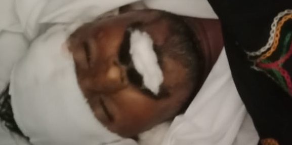 ٽرالر  جو رڪشاکي ٽڪر، هڪ فوت، ڊرائيور گرفتار