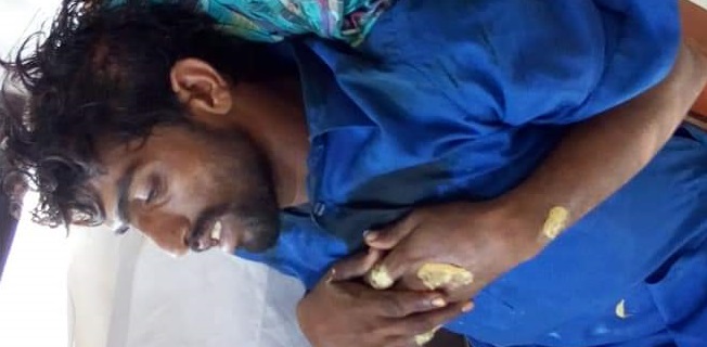 ٻن موٽر سائڪلن ۾ آمهون سامهون ٽڪر زال مڙس زخمي