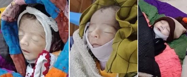 آڪسيجن ختم ٿيڻ سبب 4 ٻار فوت، نجي اسپتال سِيل، ملازم فرار