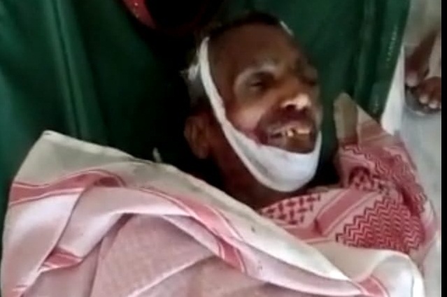 قومي شاهراهه تي حادثو، هڪ فوت، نينگر زخمي