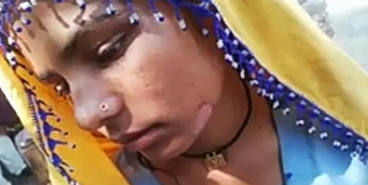مڙس پاران لوهه تپائي زال جي جسم تي ڏنڀ، تشدد