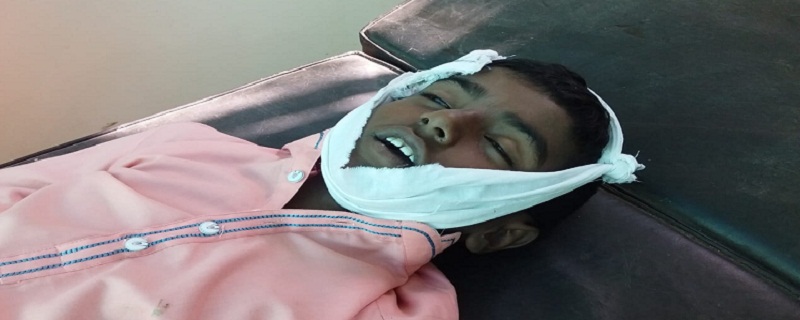 بجلي جي کُليل تار مان ڪرنٽ، 10 ورهين جو نينگر فوت