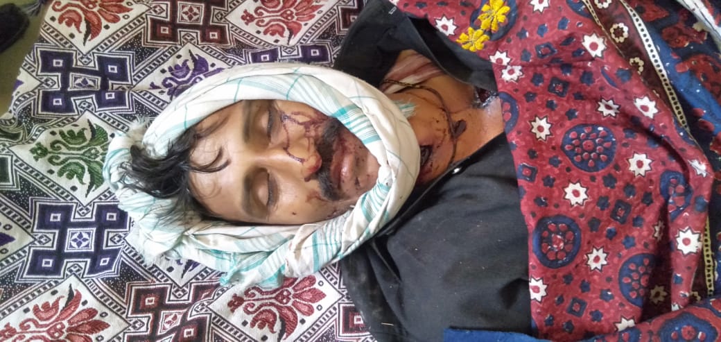 سنڌ جي مختلف شهرن ۾ حادثن سبب 4 فوت 9 زخمي