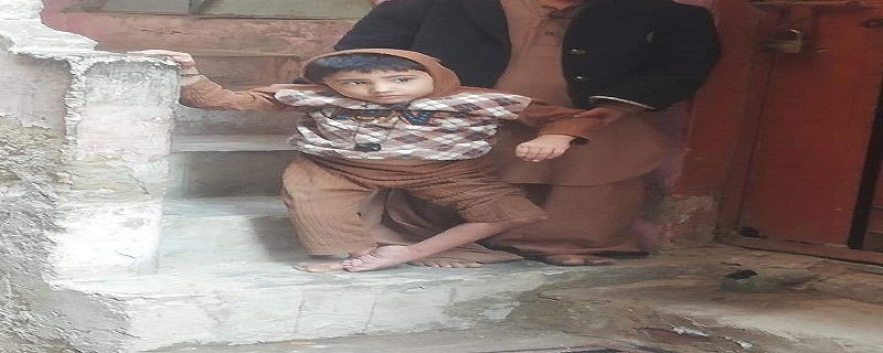 نينگريءَ ۾ پوليو جو ڪيس ظاهر، گهمڻ ڦرڻ کان لاچار