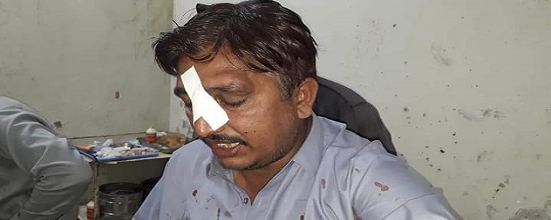 قائمخاني ۽ ملڪ برادرين جي ٻن ڌرين ۾ جهيڙو 5 زخمي