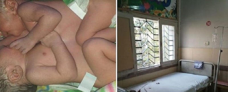 سيسي اسپتال جسم مليل جاڙن ٻارن جي پيدائش
