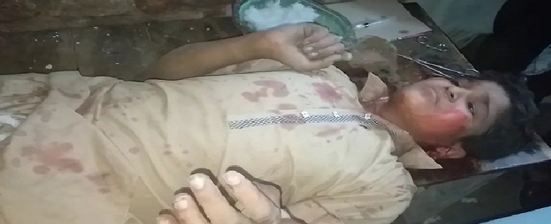 سنڌ ۾ حادثا ۽ جهيڙا 3 فوت ۽ 11 ڄڻا زخمي ٿي پيا