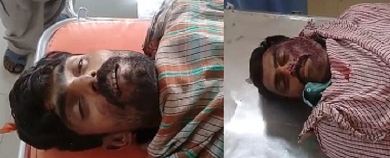 ايڪسيدنٽ، ڪرنٽ ۽ جهيڙي سبب 3 فوت 2 زخمي