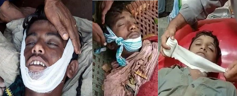 وڄ ڪرڻ جي مختلف واقعن ۾ 3 ماڻهو ۽ سوين ڍور فوت