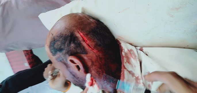 زمين جي مالڪي تان رند برادري جي ٻن ڌرين ۾ جھيڙو، 8 ڄڻا زخمي