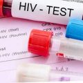 HIV