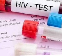 HIV