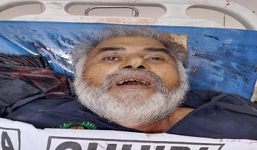 پوليس جي لاپرواهي، ڦورن صحافي کي قتل ڪري ڇڏيو