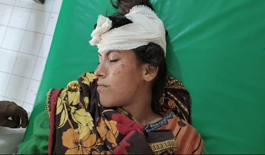معمولي ڳالھ تان جھيڙو ٽن عورتن سميت 4 ڄڻا زخمي، اسپتال منتقل