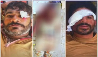 گوادر ۾ مظاهرين جو فورسز تي حملو، هڪ جوان شهيد، 16 زخمي
